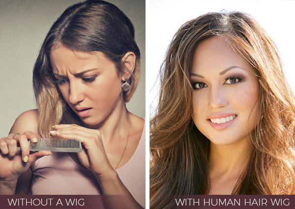 3 Wig Types for Women With Thinning Hair - Ultimate Looks